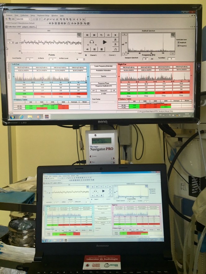 Peste 500 de pacienți minori, inclusiv nou-născuți, au beneficiat de testare audiologică performantă