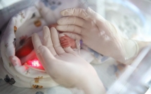 România are o rată a mortalității infantile mult peste media UE, în rural atingând chiar dublul mediei din Uniune